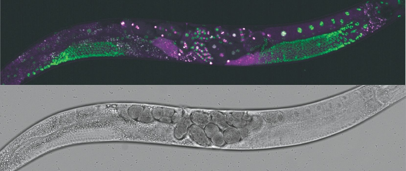 Transparent worms under a microscope